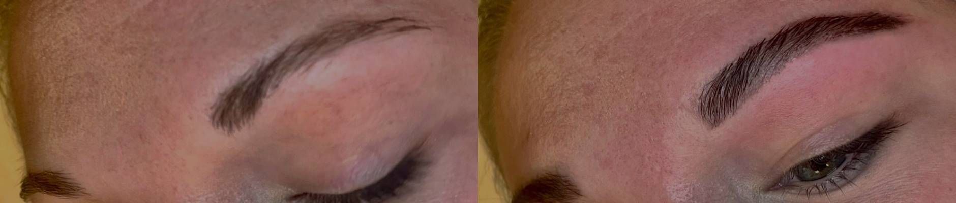 Brow Lamination