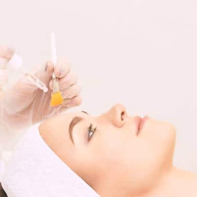 CHEMICAL PEELS